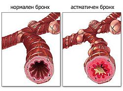 алергия на работното място