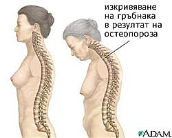 причини при жените