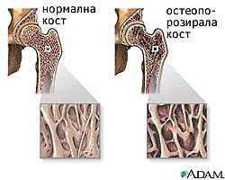 причини при мъжете