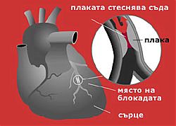 симптоми и усложнения