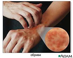 прояви