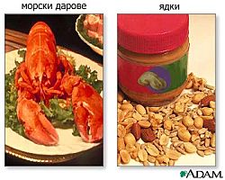 хранителна алергия